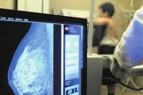 NFZ utrudnia kobietom dostęp do mammografu