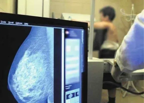 NFZ utrudnia kobietom dostęp do mammografu